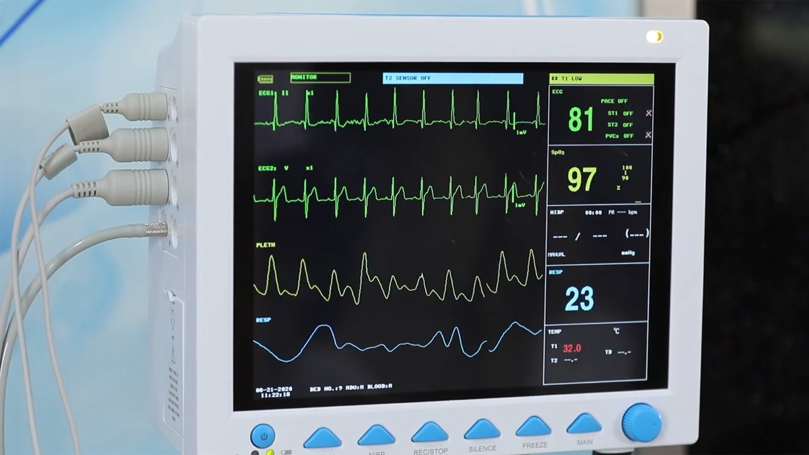 Contec CMS8000 Patient Monitor